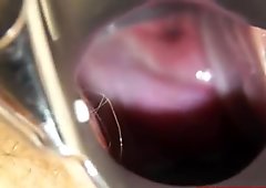 Madam gyno in addition to a redhead bitch