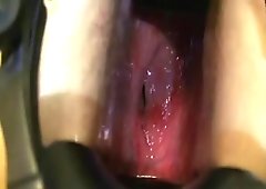 Ass brutally gaped by huge speculum and dildo